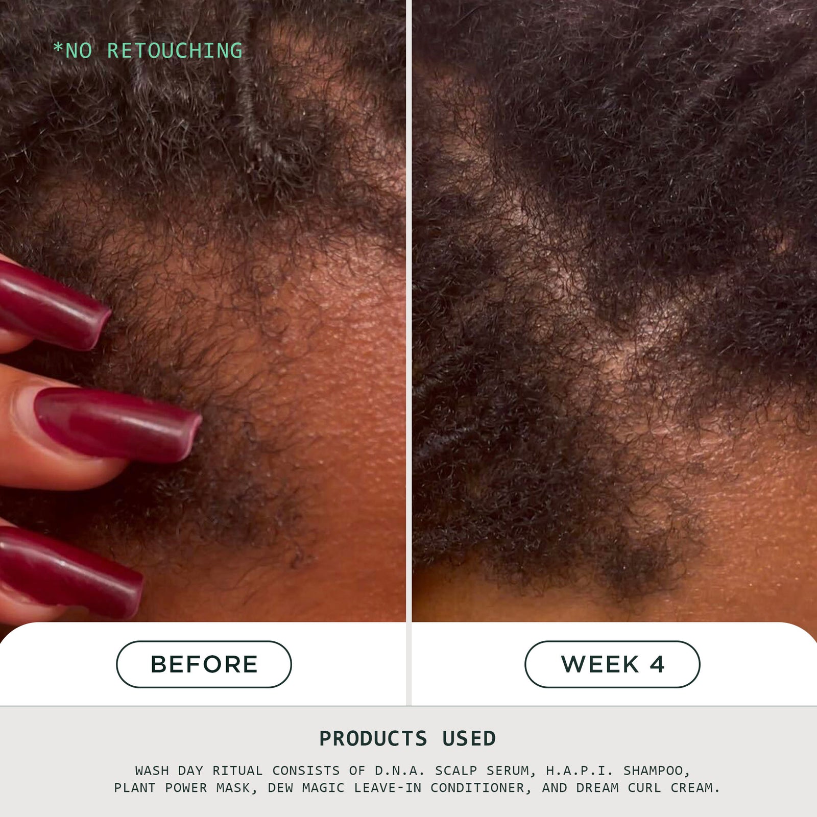 D.N.A. Scalp Serum for Thinning Hair by Sienna Naturals (Vegan